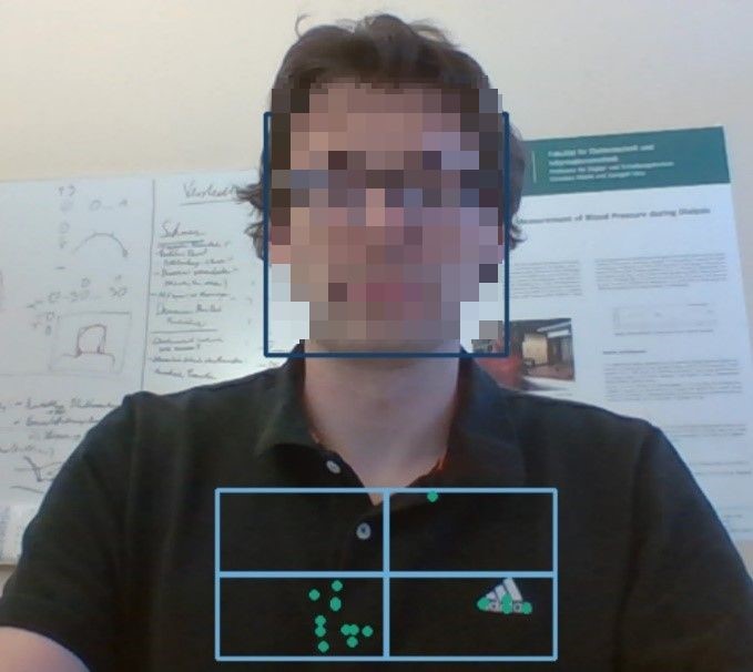 Anonymisiertes Foto einer Person mit der Anzeige des Systems zur Vitalparametererkennung