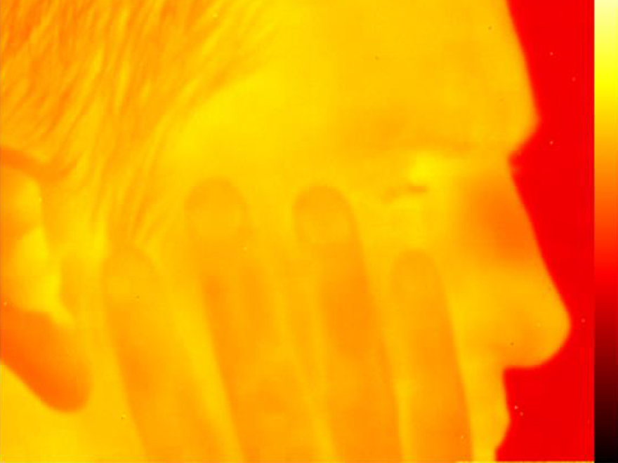 Thermografiebild eines Gesichts mit Hand