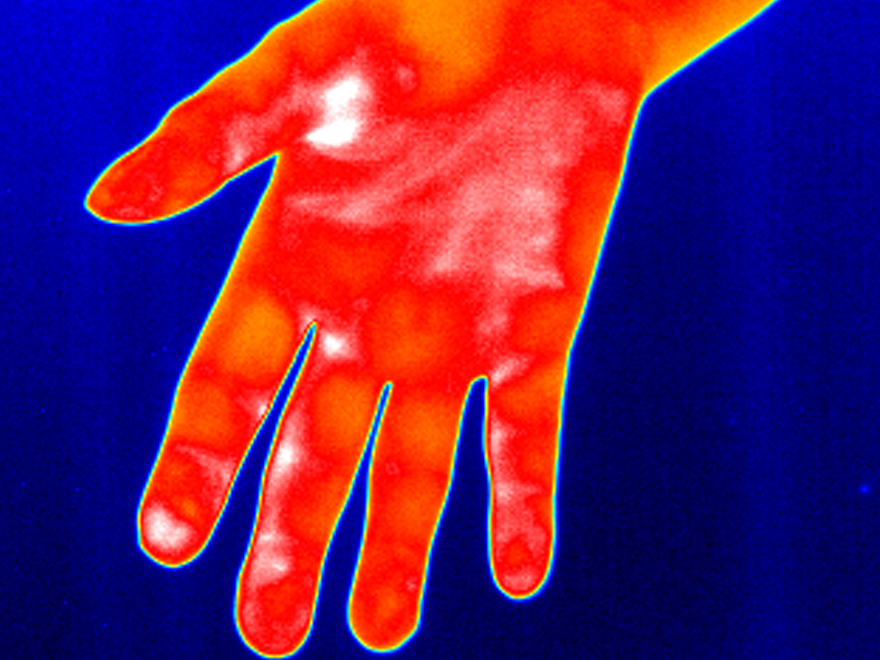 Thermographic image of a heavily perfused hand