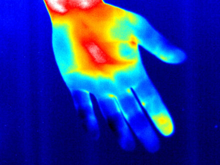 Thermographic image of the index finger